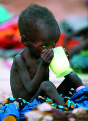 malnourished child